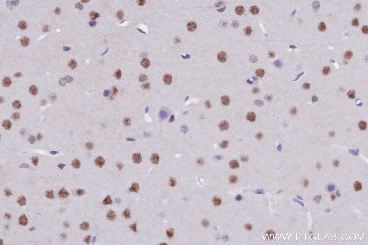 Immunohistochemical analysis of paraffin-embedded rat brain tissue slide using KHC2794 (SMARCD1 IHC Kit).