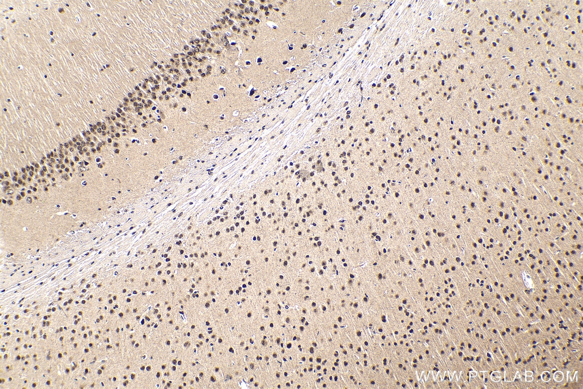 Immunohistochemical analysis of paraffin-embedded mouse brain tissue slide using KHC1791 (SMARCD3 IHC Kit).