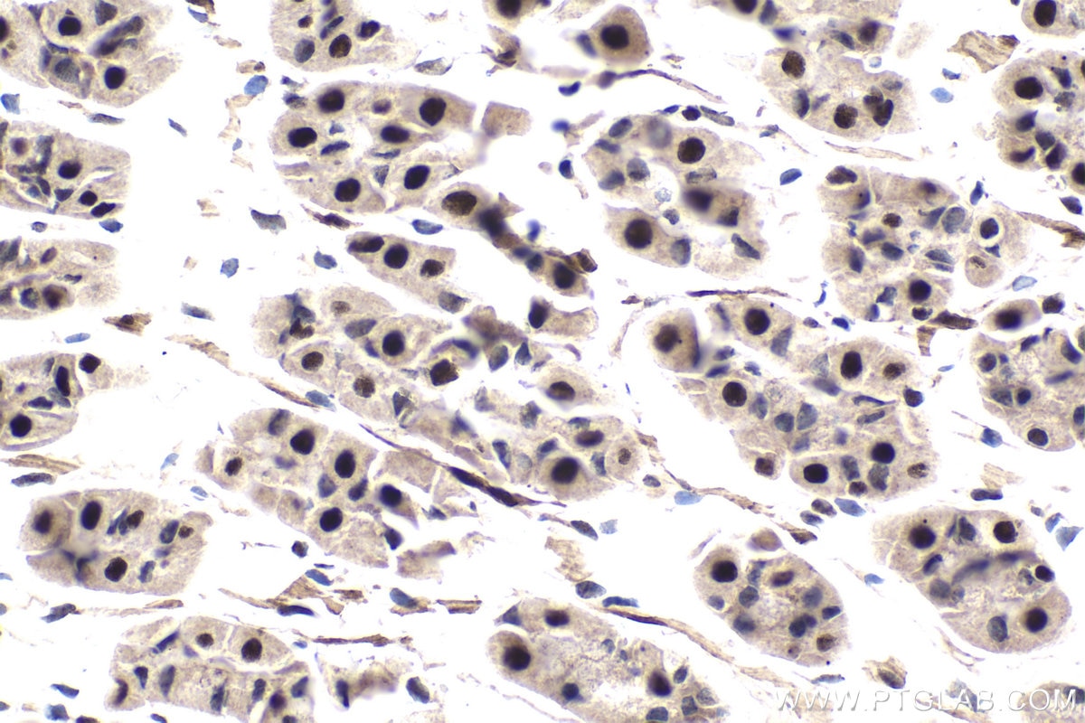 Immunohistochemical analysis of paraffin-embedded mouse stomach tissue slide using KHC1791 (SMARCD3 IHC Kit).