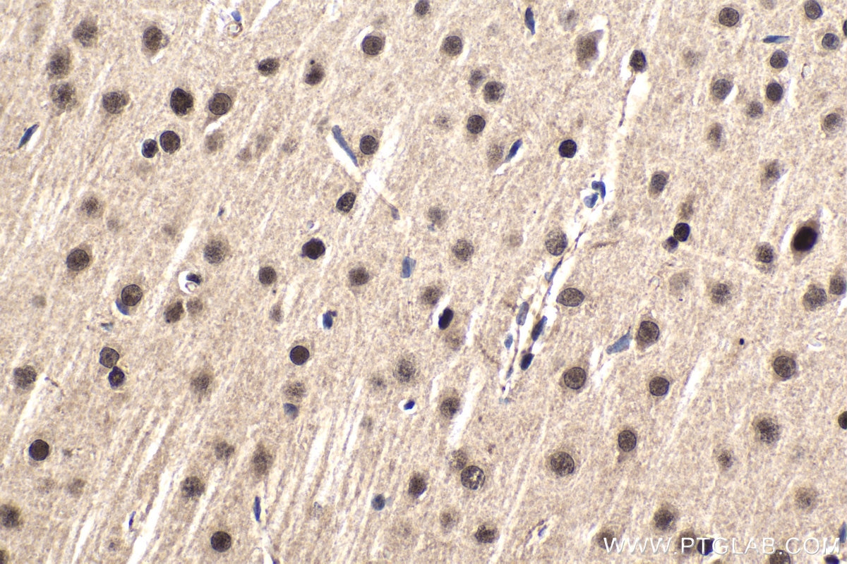 Immunohistochemical analysis of paraffin-embedded rat brain tissue slide using KHC1791 (SMARCD3 IHC Kit).