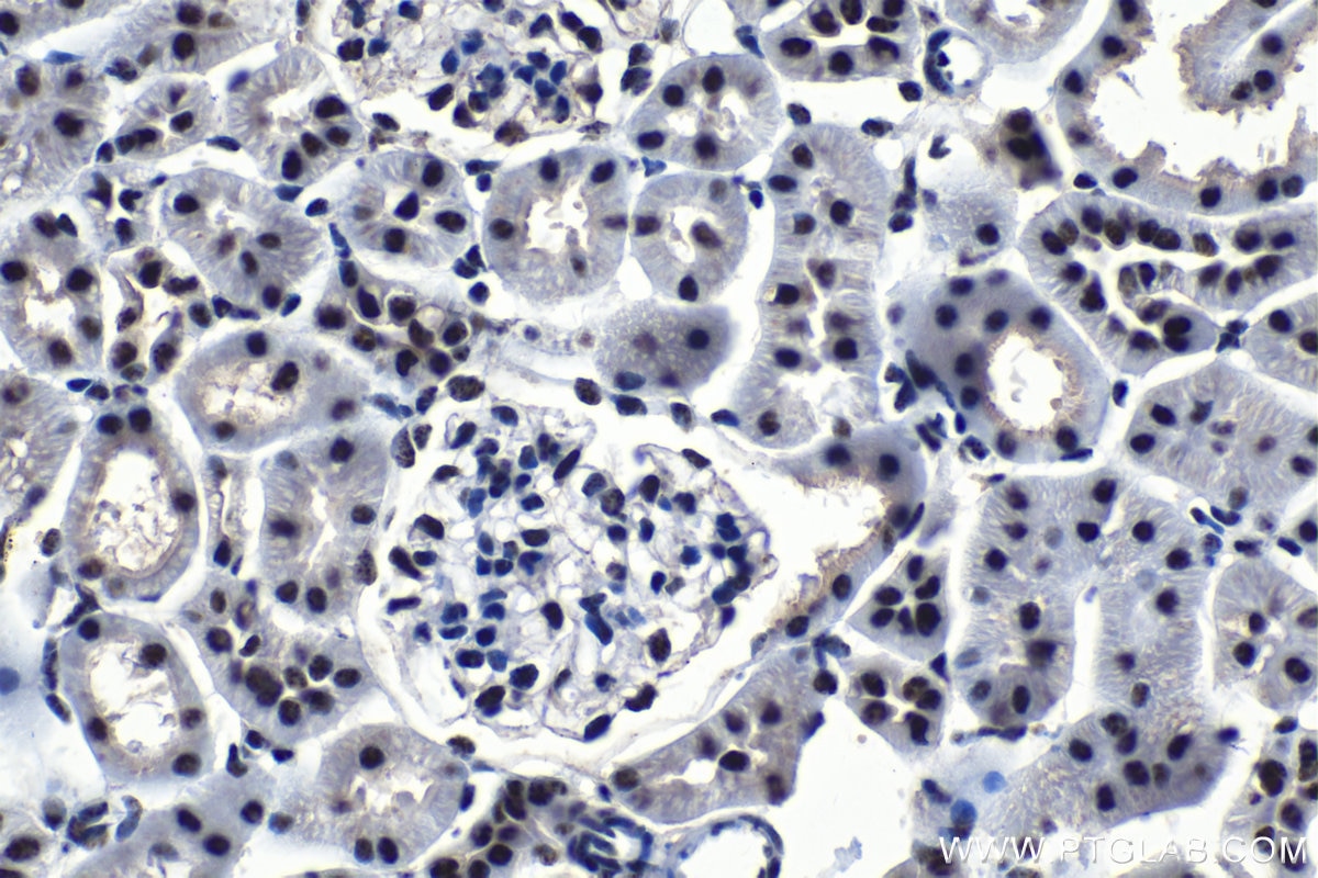 Immunohistochemical analysis of paraffin-embedded rat kidney tissue slide using KHC1212 (SMARCE1 IHC Kit).