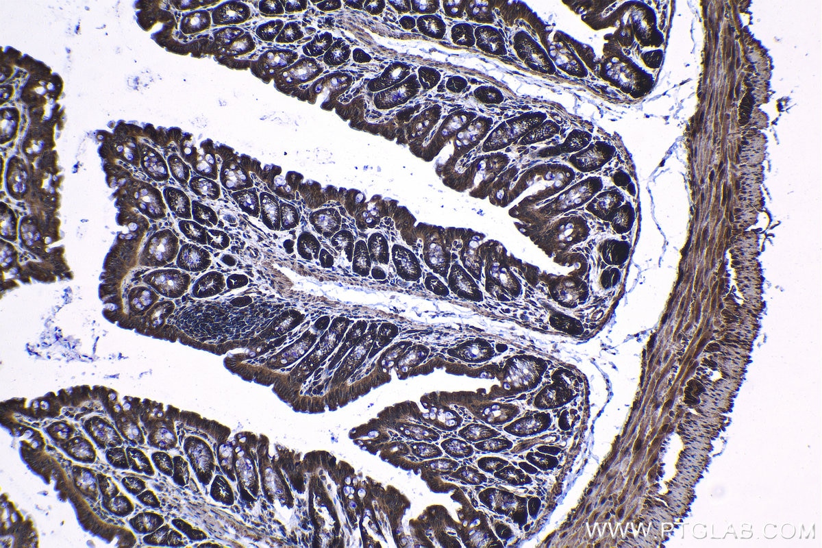 Immunohistochemical analysis of paraffin-embedded mouse colon tissue slide using KHC1221 (SMC4 IHC Kit).