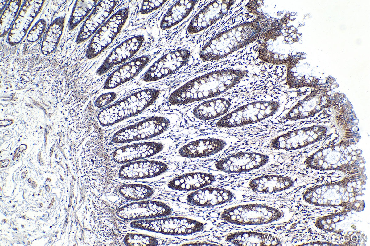 Immunohistochemical analysis of paraffin-embedded human colon tissue slide using KHC1221 (SMC4 IHC Kit).