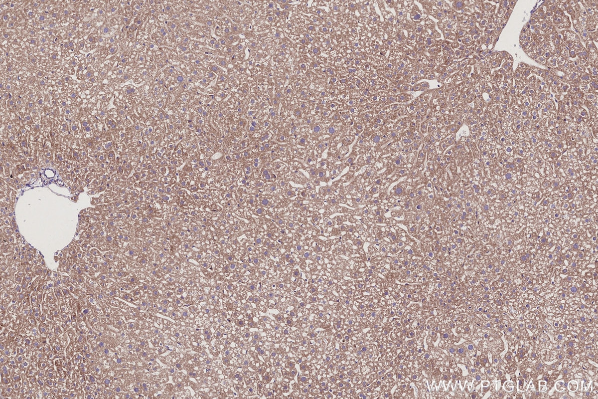 Immunohistochemical analysis of paraffin-embedded mouse liver tissue slide using KHC2942 (SMCR7L/MID51 IHC Kit).