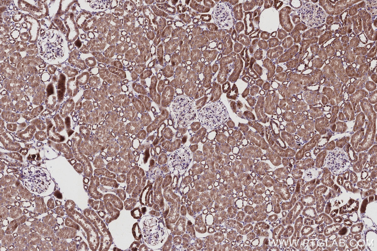 Immunohistochemical analysis of paraffin-embedded rat kidney tissue slide using KHC2942 (SMCR7L/MID51 IHC Kit).