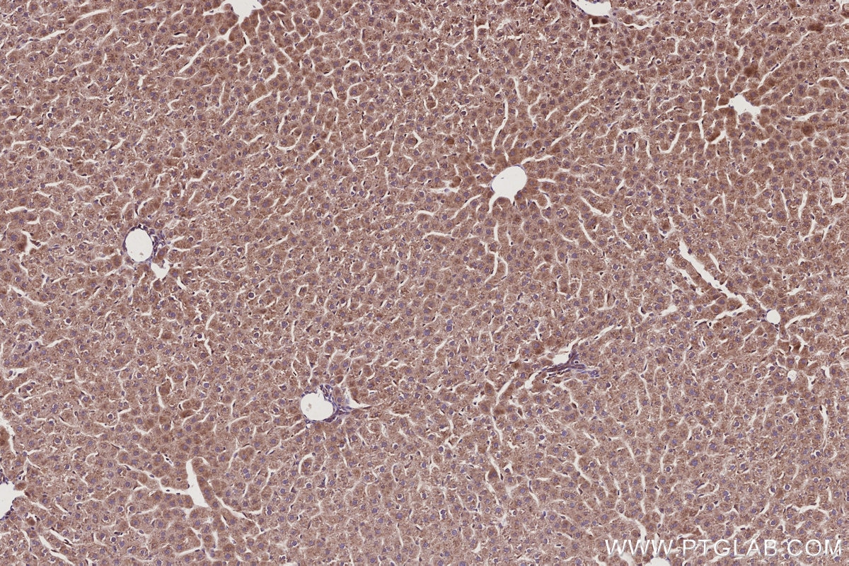 Immunohistochemical analysis of paraffin-embedded rat liver tissue slide using KHC2942 (SMCR7L/MID51 IHC Kit).