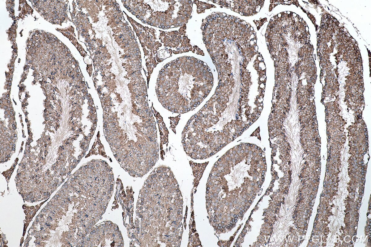 Immunohistochemical analysis of paraffin-embedded mouse testis tissue slide using KHC0138 (SMO IHC Kit).