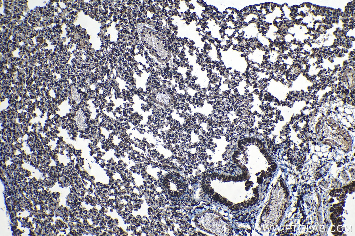 Immunohistochemical analysis of paraffin-embedded mouse lung tissue slide using KHC1313 (SMU1 IHC Kit).