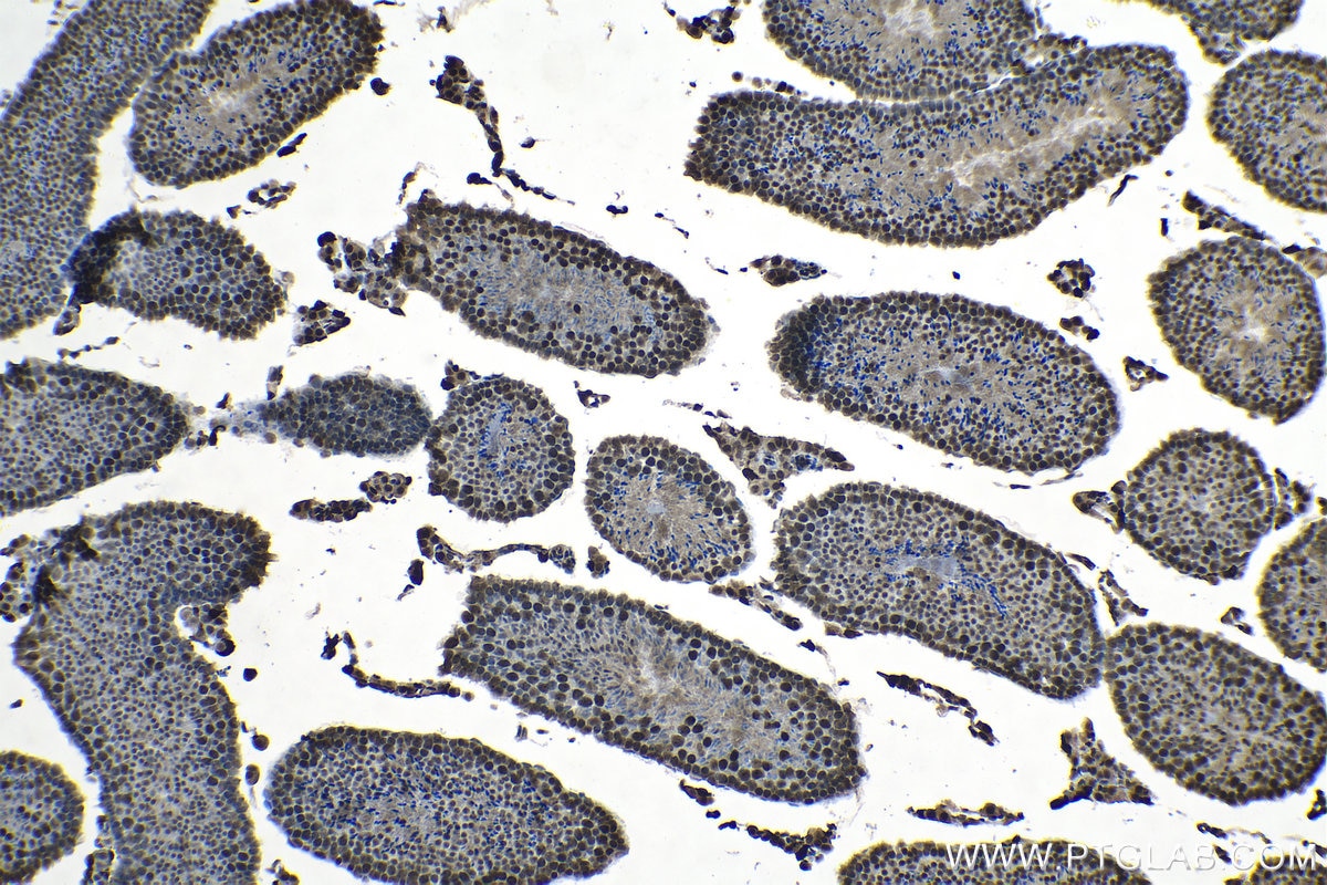 Immunohistochemical analysis of paraffin-embedded mouse testis tissue slide using KHC1313 (SMU1 IHC Kit).