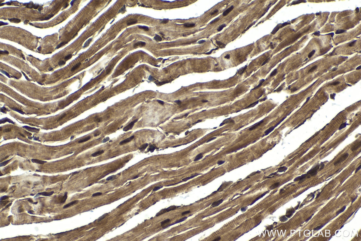 Immunohistochemical analysis of paraffin-embedded mouse heart tissue slide using KHC1834 (SMYD1 IHC Kit).