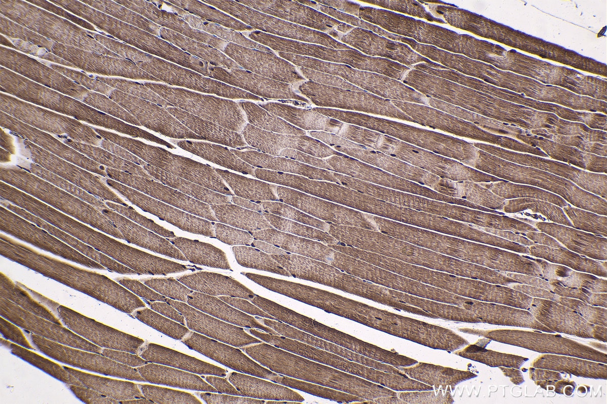 Immunohistochemical analysis of paraffin-embedded mouse skeletal muscle tissue slide using KHC1834 (SMYD1 IHC Kit).