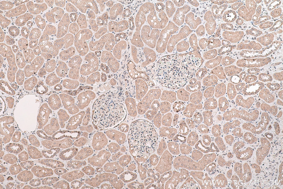 Immunohistochemical analysis of paraffin-embedded human kidney tissue slide using KHC0769 (SMYD2 IHC Kit).