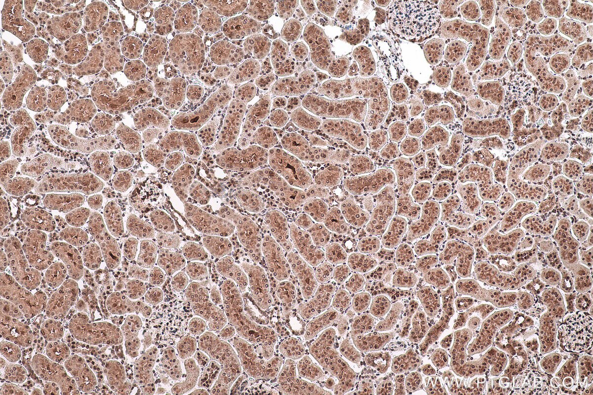 Immunohistochemical analysis of paraffin-embedded rat kidney tissue slide using KHC0769 (SMYD2 IHC Kit).