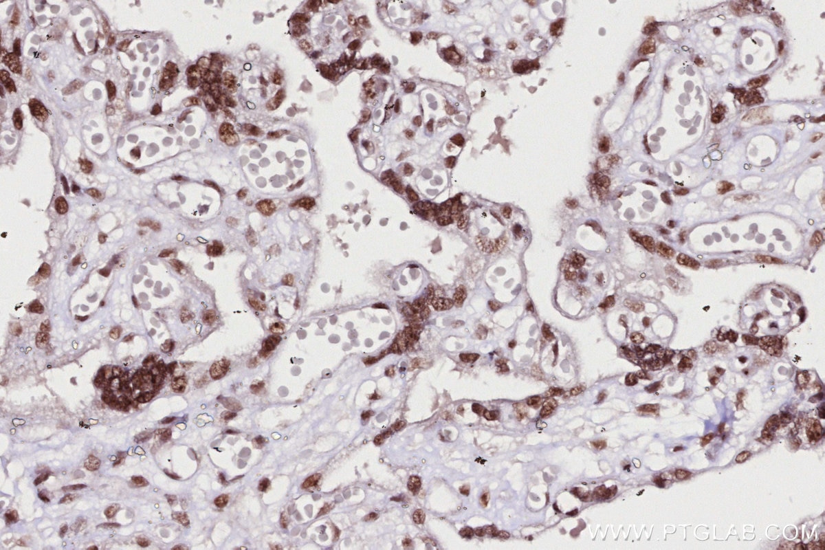 Immunohistochemical analysis of paraffin-embedded human placenta tissue slide using KHC2703 (SNIP1 IHC Kit).