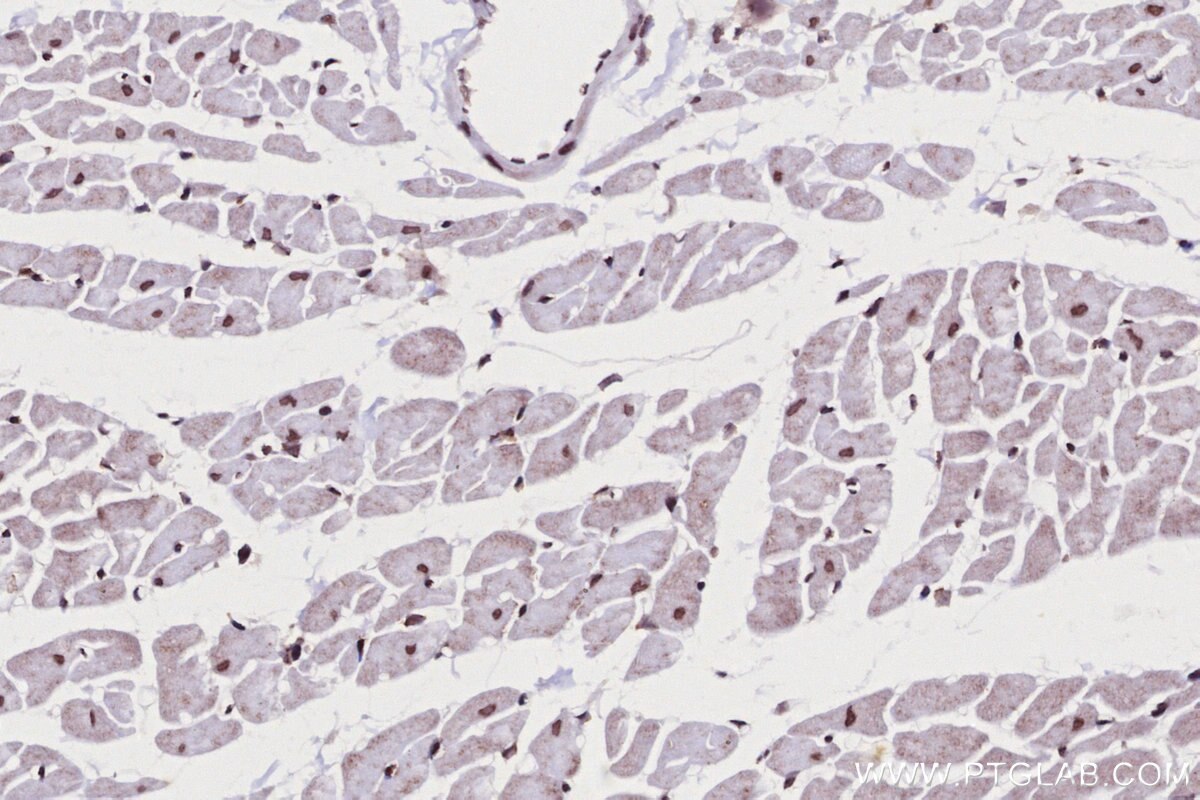 Immunohistochemical analysis of paraffin-embedded rat heart tissue slide using KHC2703 (SNIP1 IHC Kit).