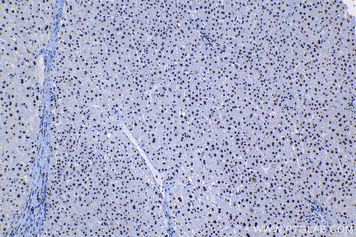 Immunohistochemical analysis of paraffin-embedded human liver tissue slide using KHC1306 (SNRPA1 IHC Kit).