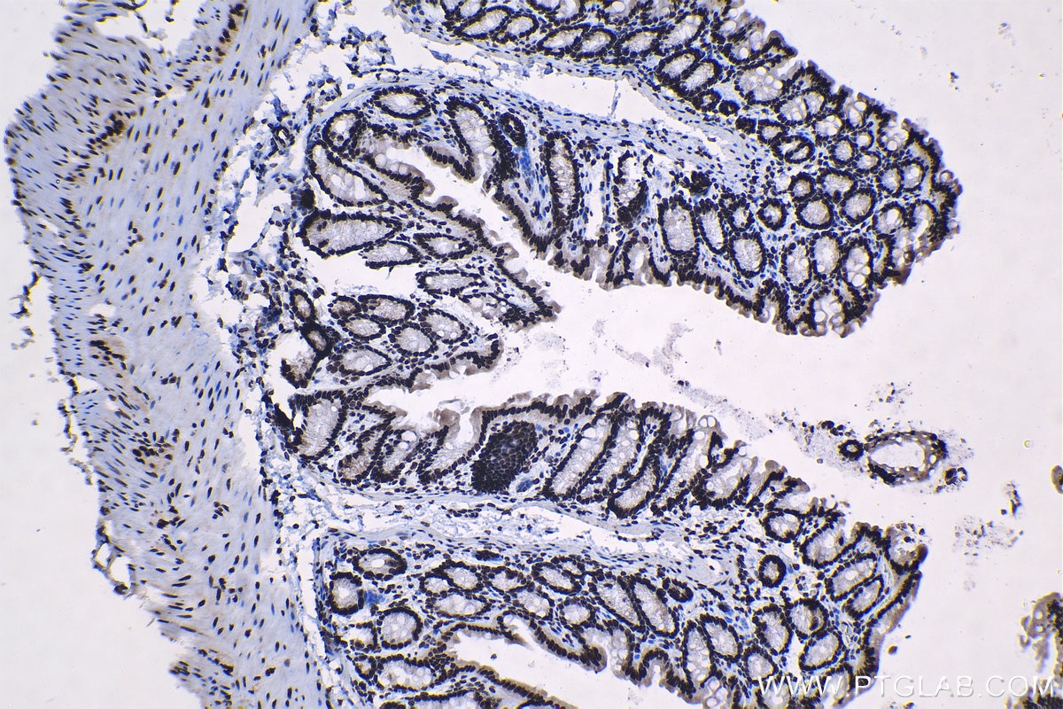 Immunohistochemical analysis of paraffin-embedded mouse colon tissue slide using KHC1306 (SNRPA1 IHC Kit).