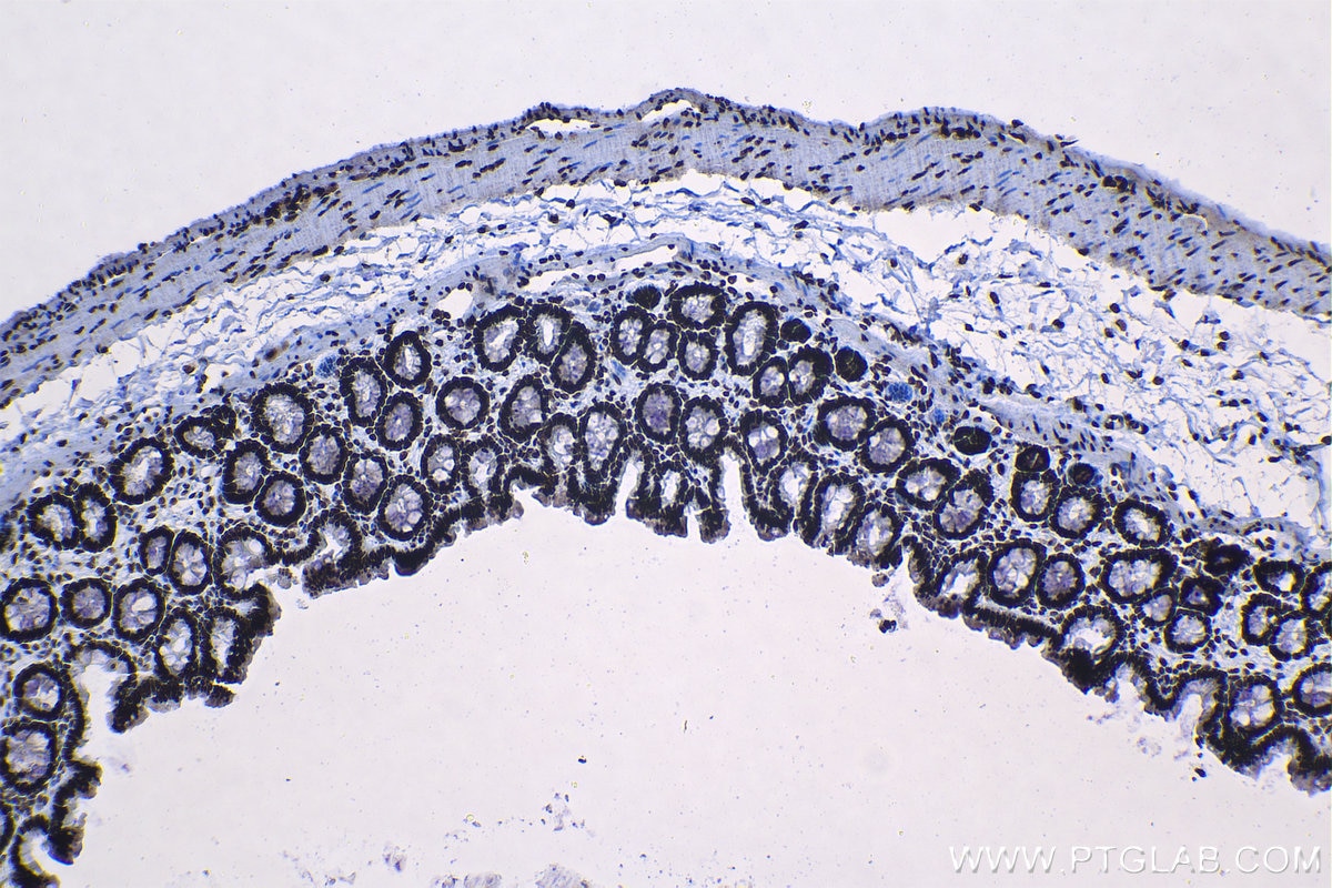 Immunohistochemical analysis of paraffin-embedded rat colon tissue slide using KHC1306 (SNRPA1 IHC Kit).