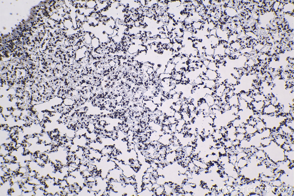 Immunohistochemical analysis of paraffin-embedded rat lung tissue slide using KHC1306 (SNRPA1 IHC Kit).