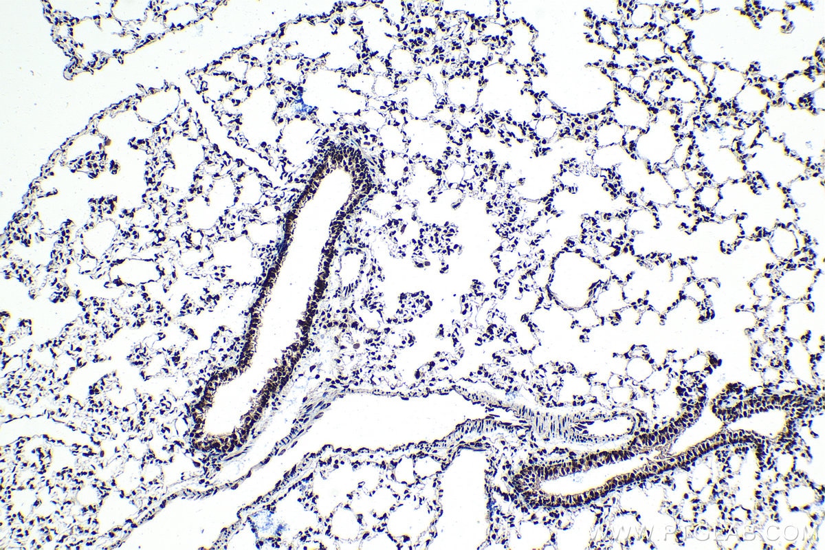 Immunohistochemical analysis of paraffin-embedded rat lung tissue slide using KHC1393 (SNRPD2 IHC Kit).