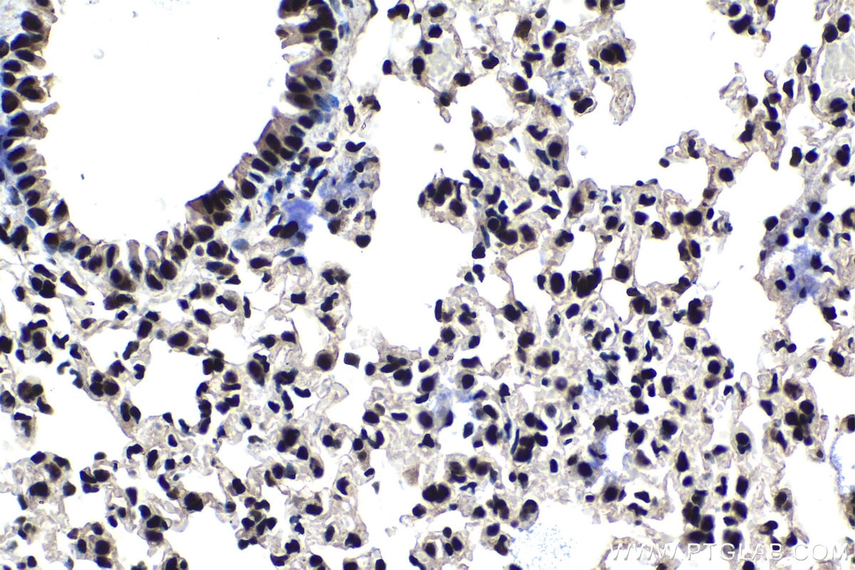 Immunohistochemical analysis of paraffin-embedded mouse lung tissue slide using KHC1393 (SNRPD2 IHC Kit).