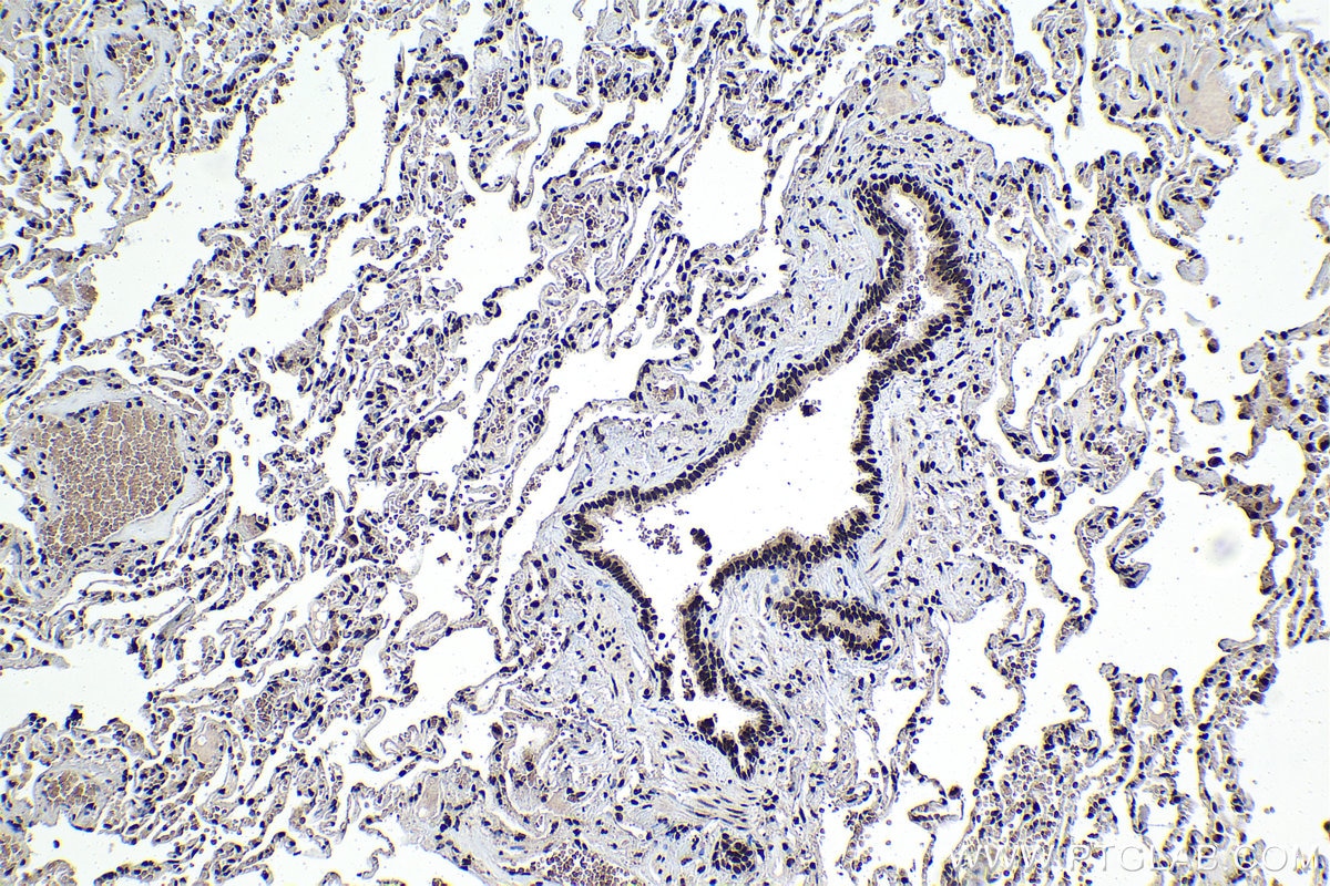 Immunohistochemical analysis of paraffin-embedded human lung tissue slide using KHC1393 (SNRPD2 IHC Kit).