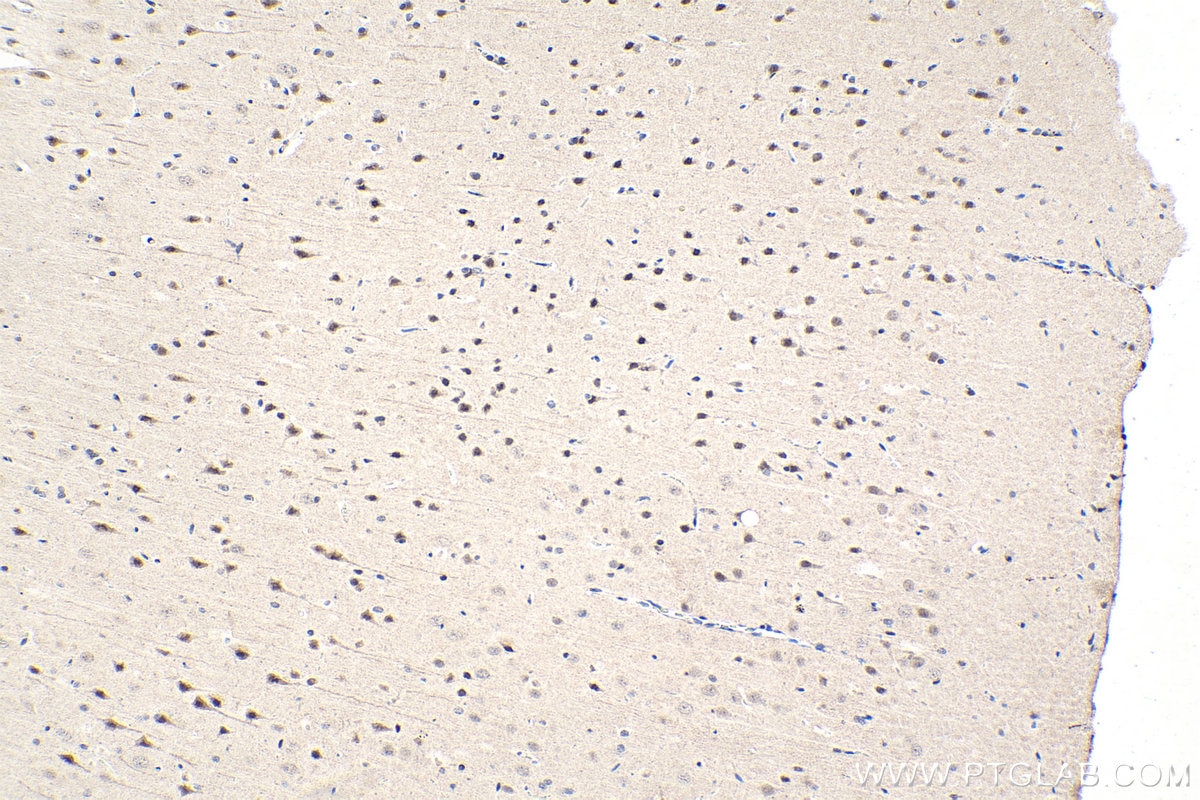 Immunohistochemical analysis of paraffin-embedded rat brain tissue slide using KHC1645 (SNRPD3 IHC Kit).