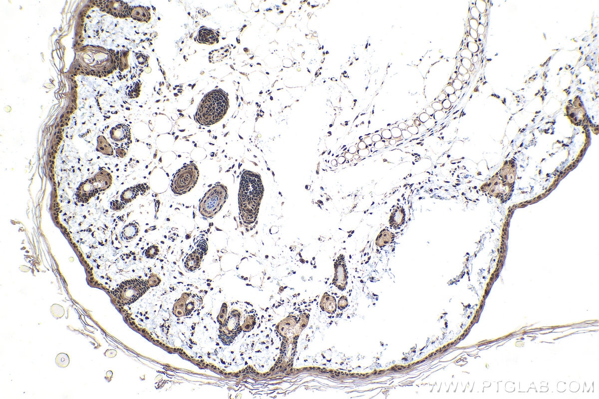 Immunohistochemical analysis of paraffin-embedded rat skin tissue slide using KHC1645 (SNRPD3 IHC Kit).