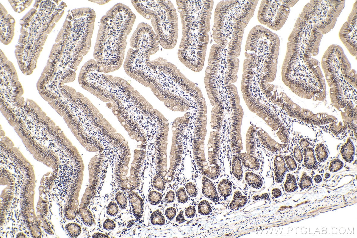 Immunohistochemical analysis of paraffin-embedded rat small intestine tissue slide using KHC1645 (SNRPD3 IHC Kit).