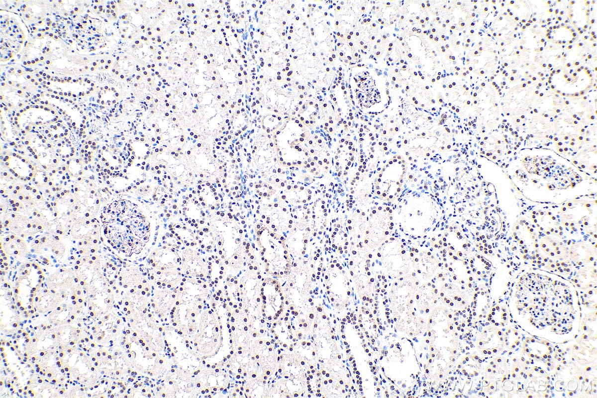 Immunohistochemical analysis of paraffin-embedded human kidney tissue slide using KHC0834 (SNRPF IHC Kit).