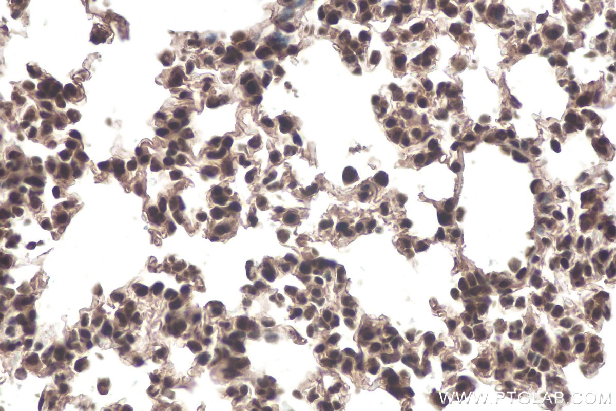 Immunohistochemical analysis of paraffin-embedded mouse lung tissue slide using KHC0882 (SNRPG IHC Kit).