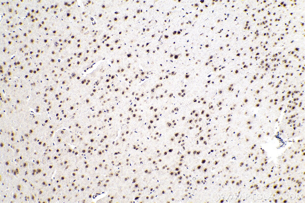 Immunohistochemical analysis of paraffin-embedded rat brain tissue slide using KHC0847 (SNU13/NHP2L1 IHC Kit).