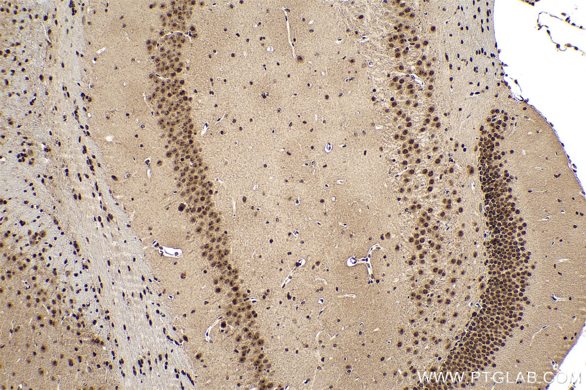 Immunohistochemical analysis of paraffin-embedded mouse brain tissue slide using KHC0847 (SNU13/NHP2L1 IHC Kit).