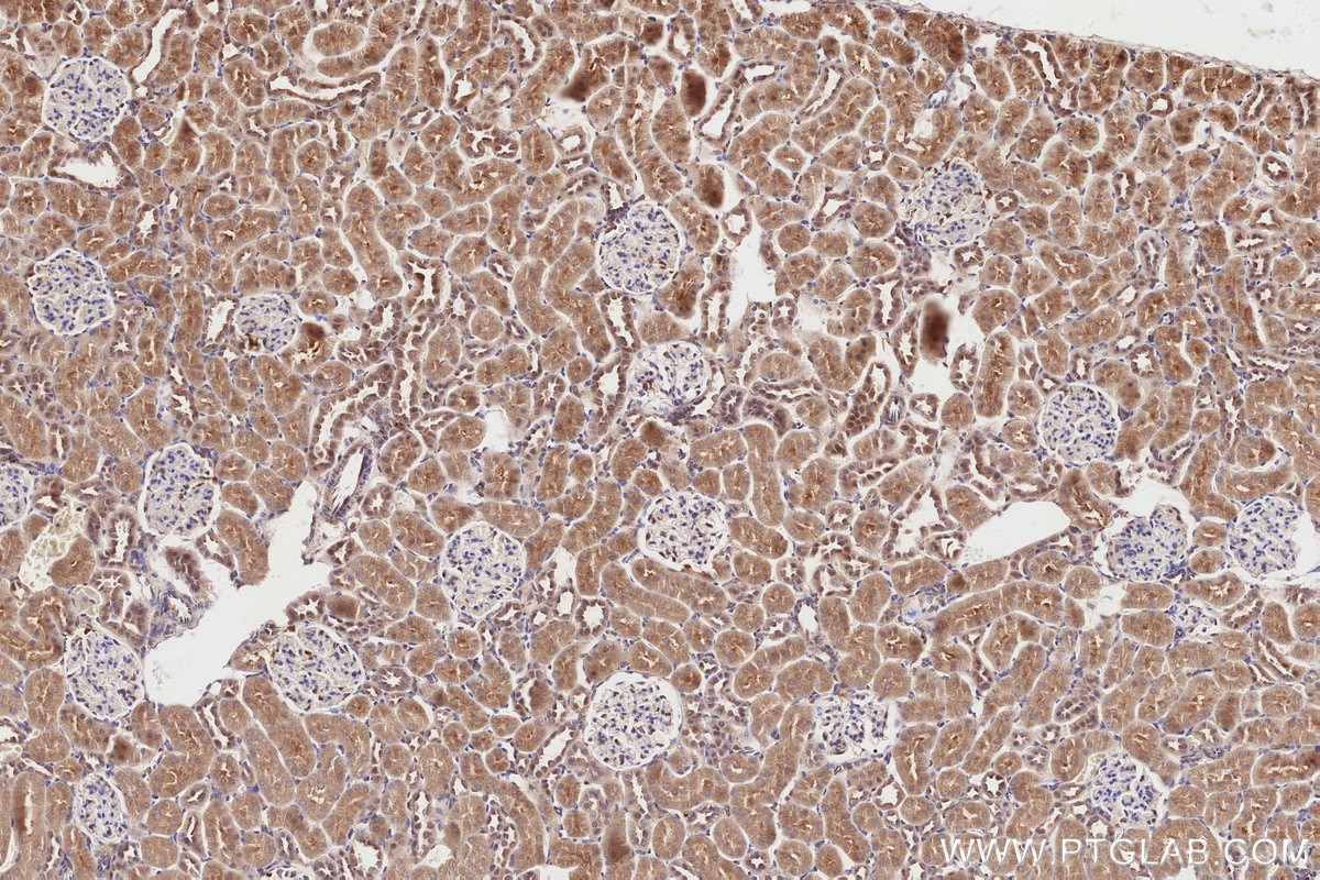 Immunohistochemical analysis of paraffin-embedded rat kidney tissue slide using KHC2825 (SNX18 IHC Kit).