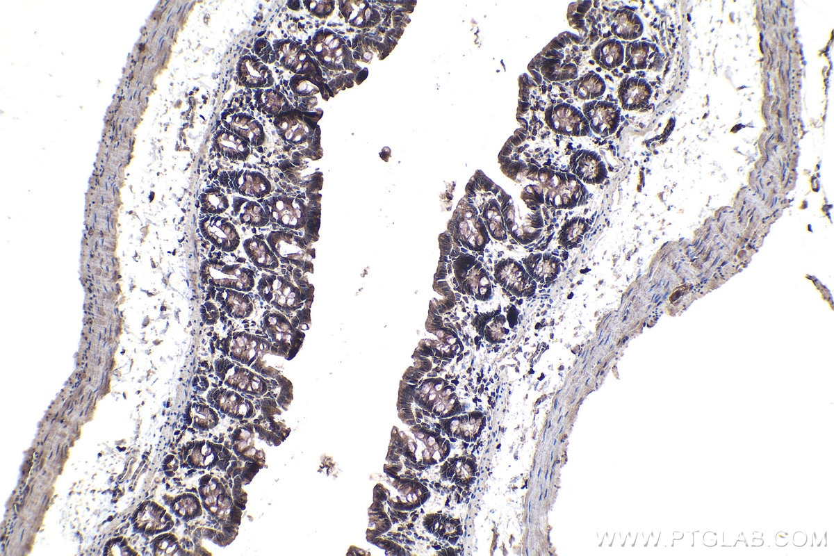 Immunohistochemical analysis of paraffin-embedded rat colon tissue slide using KHC0979 (SNX5 IHC Kit).