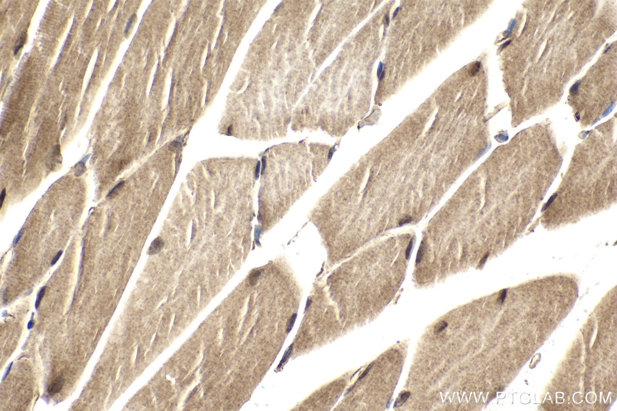 Immunohistochemical analysis of paraffin-embedded mouse skeletal muscle tissue slide using KHC2004 (SNX6 IHC Kit).