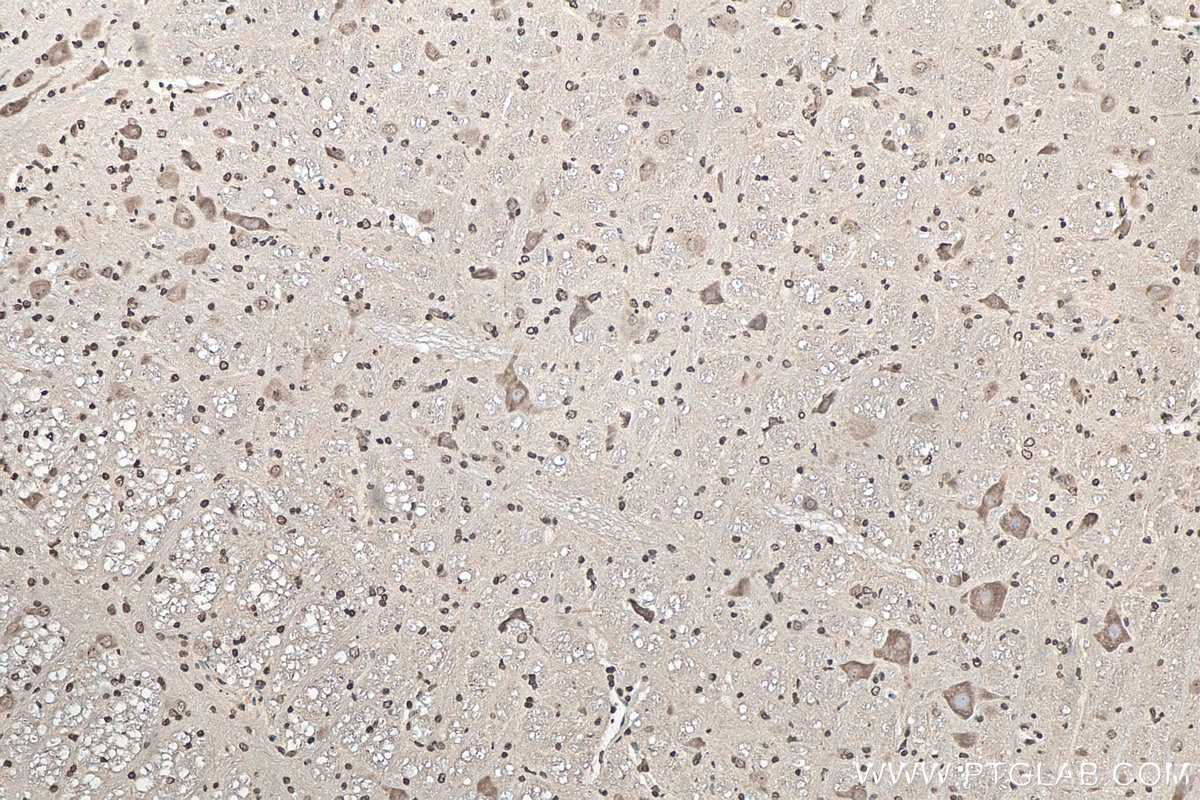 Immunohistochemical analysis of paraffin-embedded rat cerebellum tissue slide using KHC0052 (SOD1 IHC Kit).