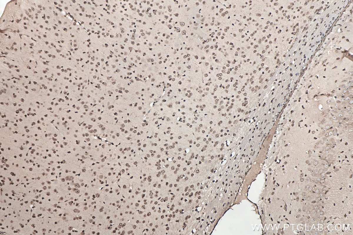 Immunohistochemical analysis of paraffin-embedded mouse brain tissue slide using KHC0052 (SOD1 IHC Kit).