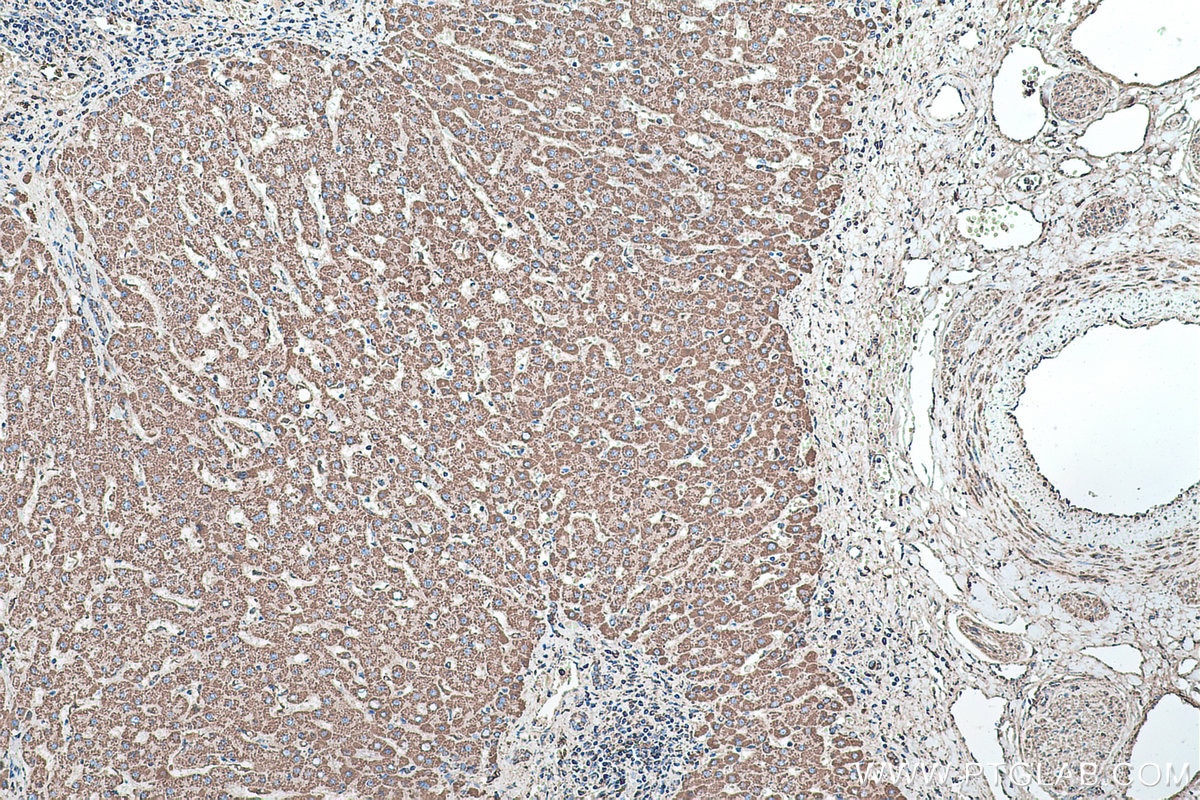 Immunohistochemical analysis of paraffin-embedded human liver tissue slide using KHC0465 (SOD2 IHC Kit).