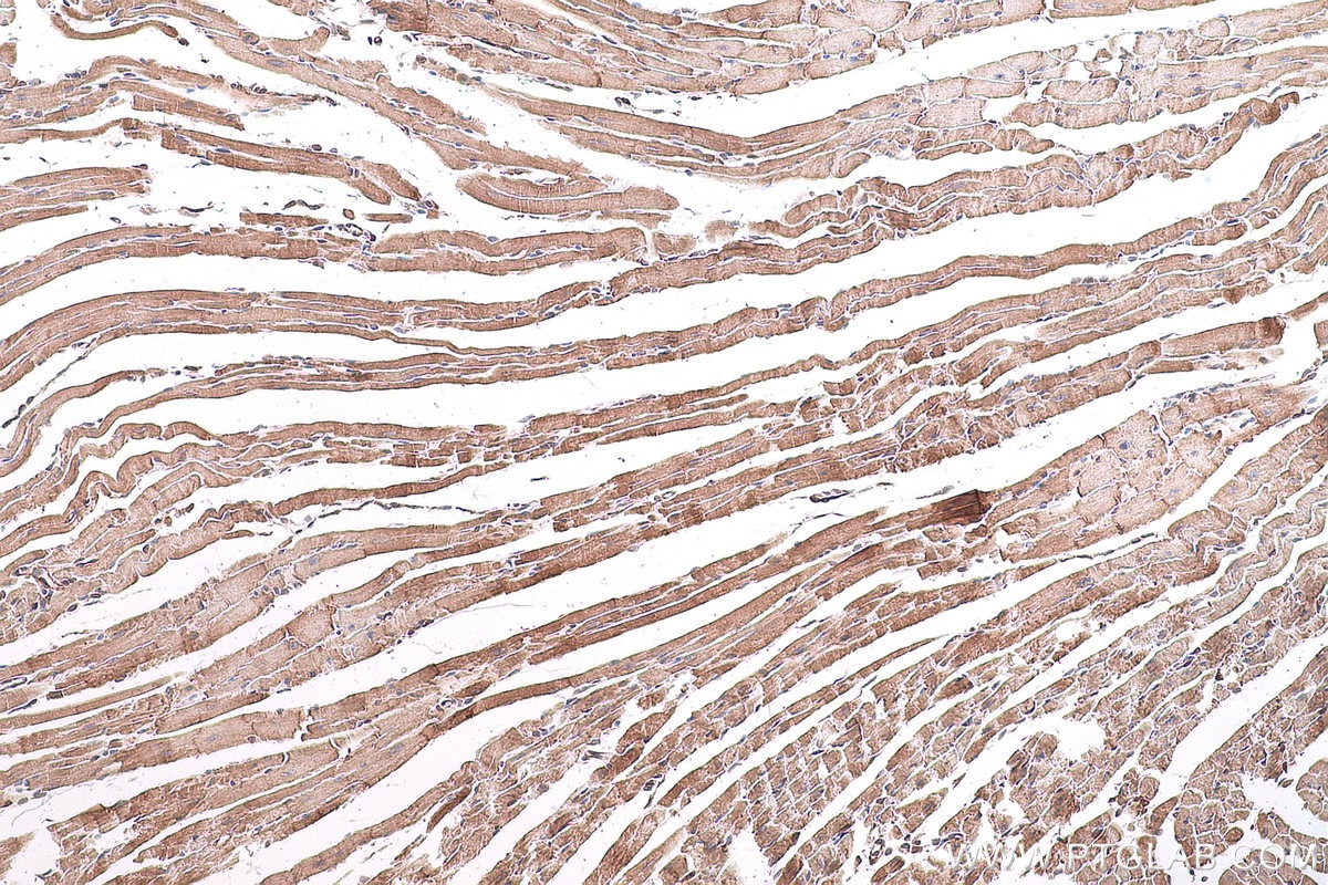 Immunohistochemical analysis of paraffin-embedded mouse heart tissue slide using KHC0829 (SORBS2 IHC Kit).