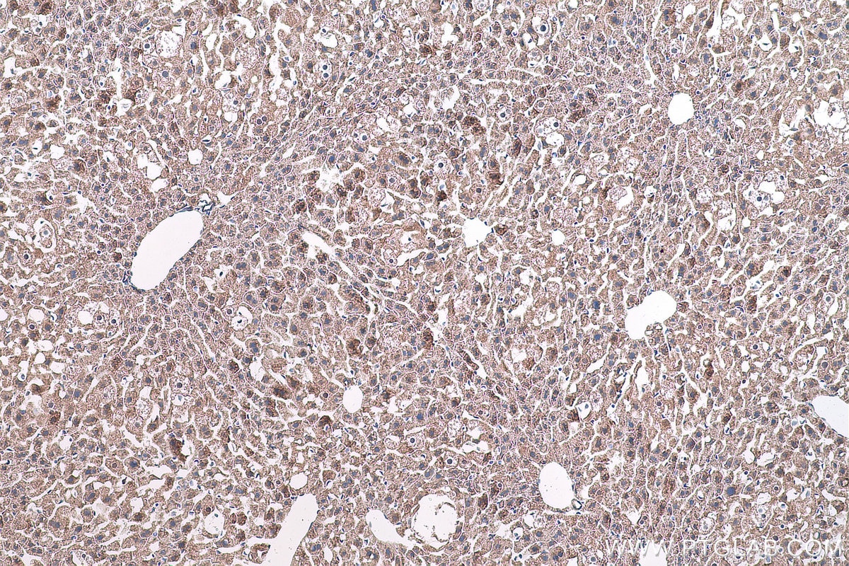 Immunohistochemical analysis of paraffin-embedded mouse liver tissue slide using KHC0829 (SORBS2 IHC Kit).