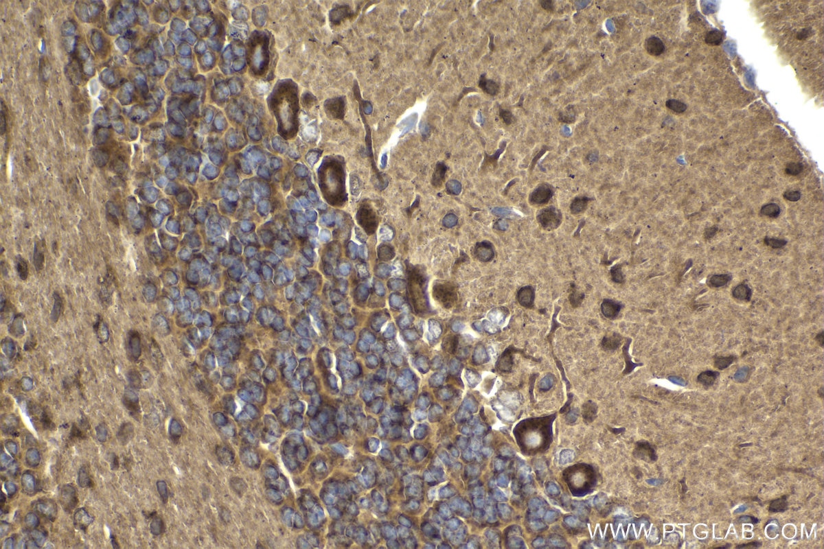 Immunohistochemical analysis of paraffin-embedded mouse cerebellum tissue slide using KHC1849 (SORL1 IHC Kit).