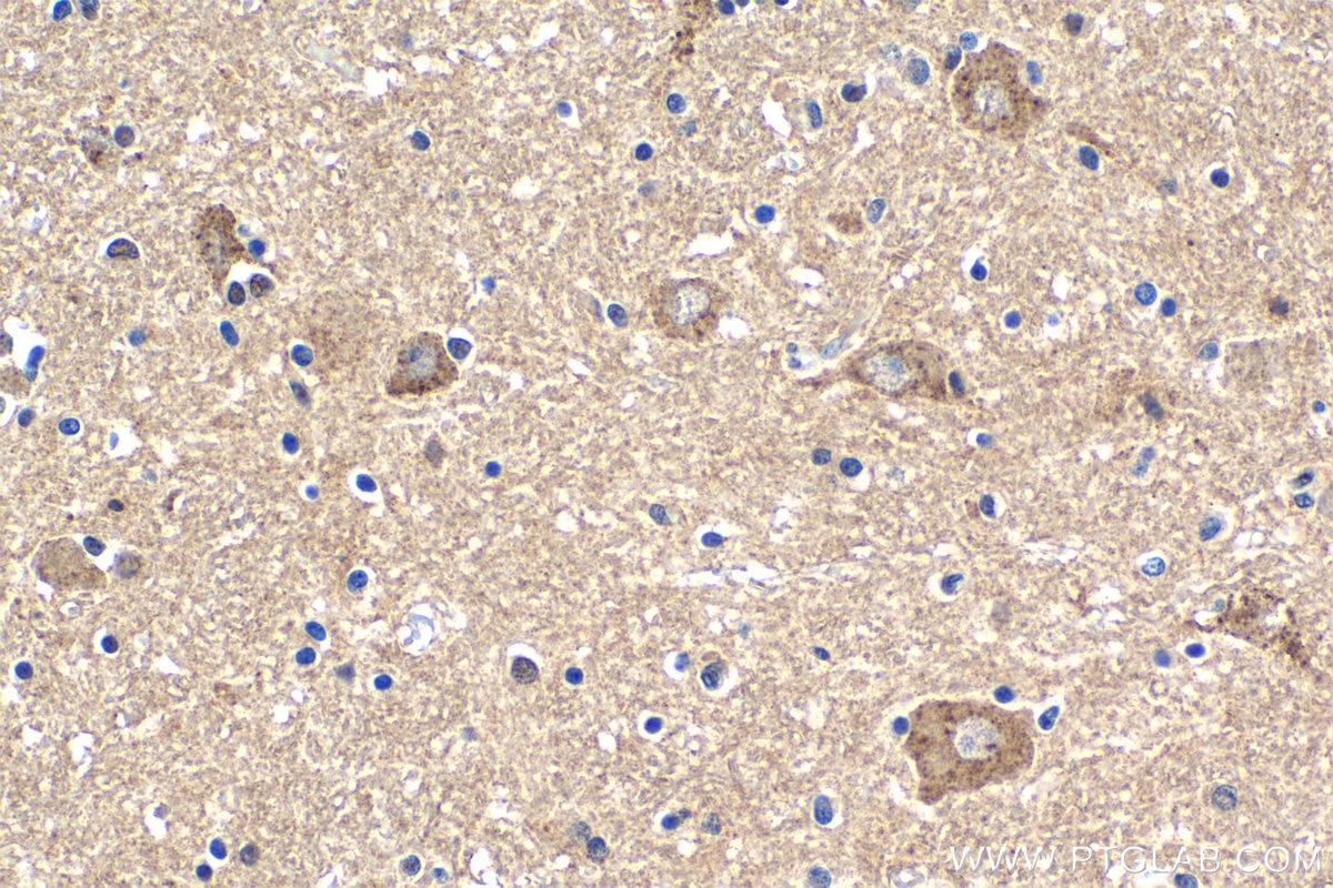 Immunohistochemical analysis of paraffin-embedded human brain tissue slide using KHC1849 (SORL1 IHC Kit).
