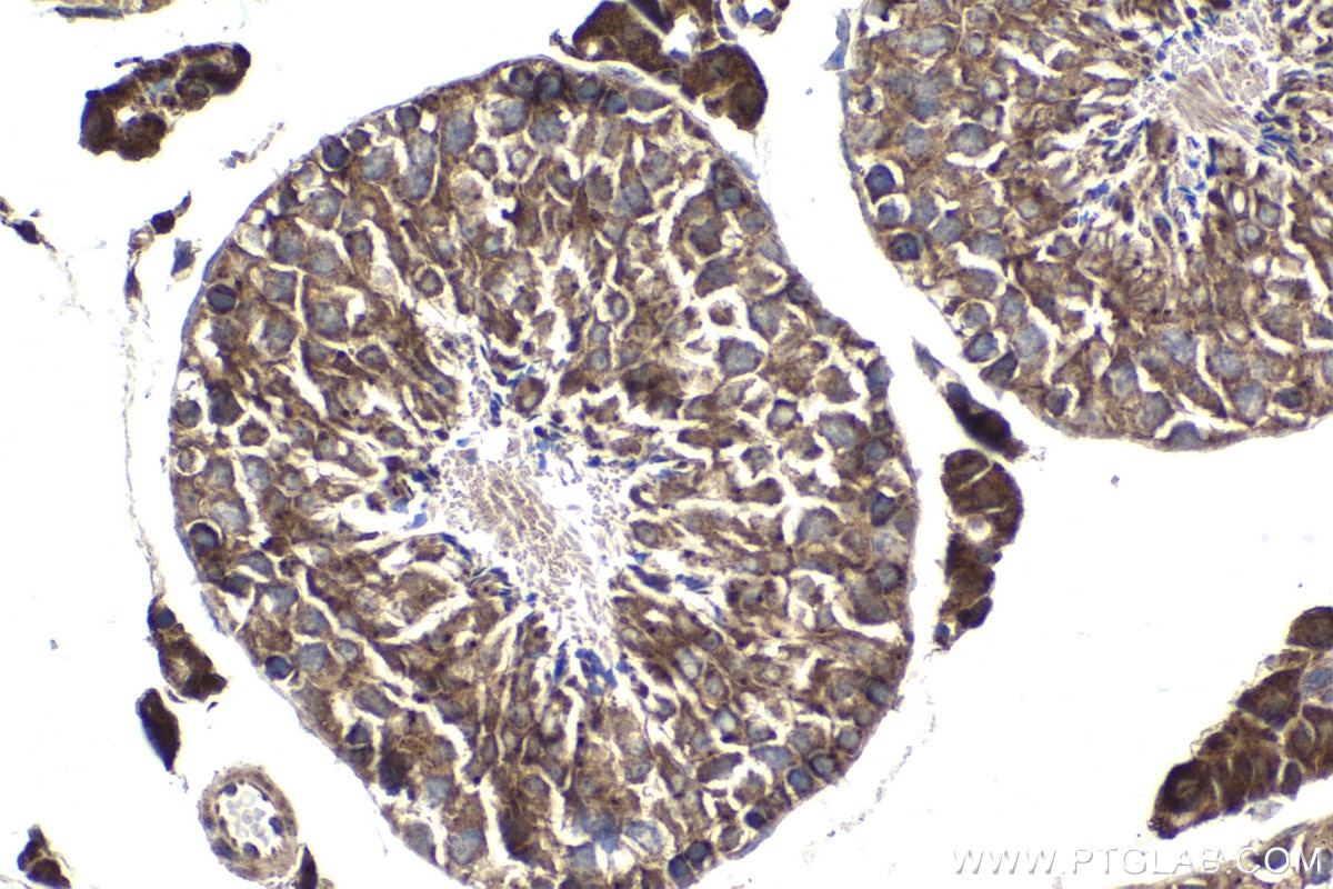 Immunohistochemical analysis of paraffin-embedded mouse testis tissue slide using KHC1849 (SORL1 IHC Kit).