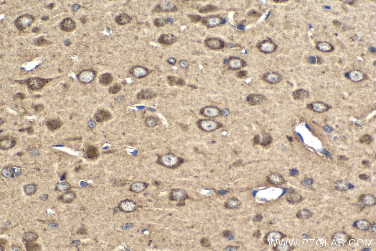 Immunohistochemical analysis of paraffin-embedded rat brain tissue slide using KHC1849 (SORL1 IHC Kit).