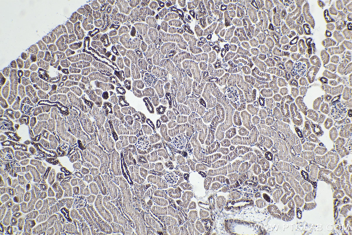 Immunohistochemical analysis of paraffin-embedded mouse kidney tissue slide using KHC1889 (SORT1 IHC Kit).