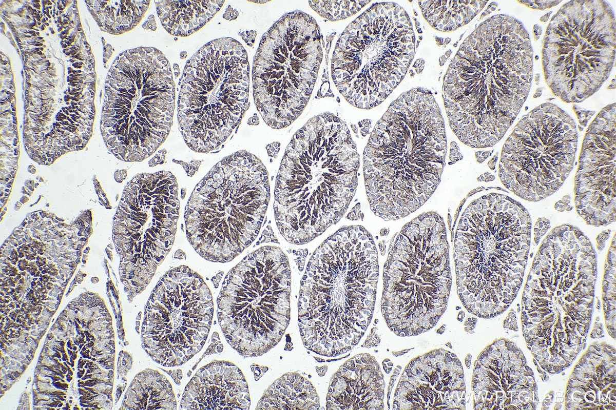Immunohistochemical analysis of paraffin-embedded mouse testis tissue slide using KHC1889 (SORT1 IHC Kit).