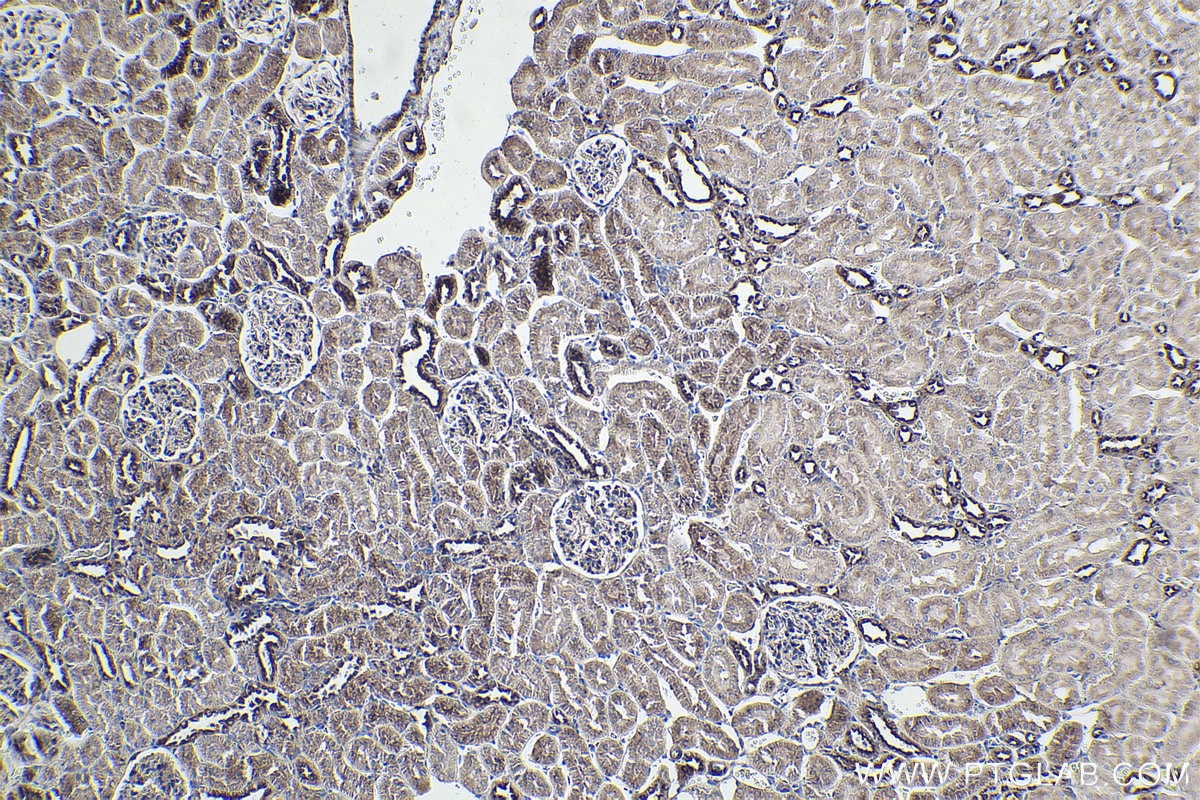 Immunohistochemical analysis of paraffin-embedded rat kidney tissue slide using KHC1889 (SORT1 IHC Kit).