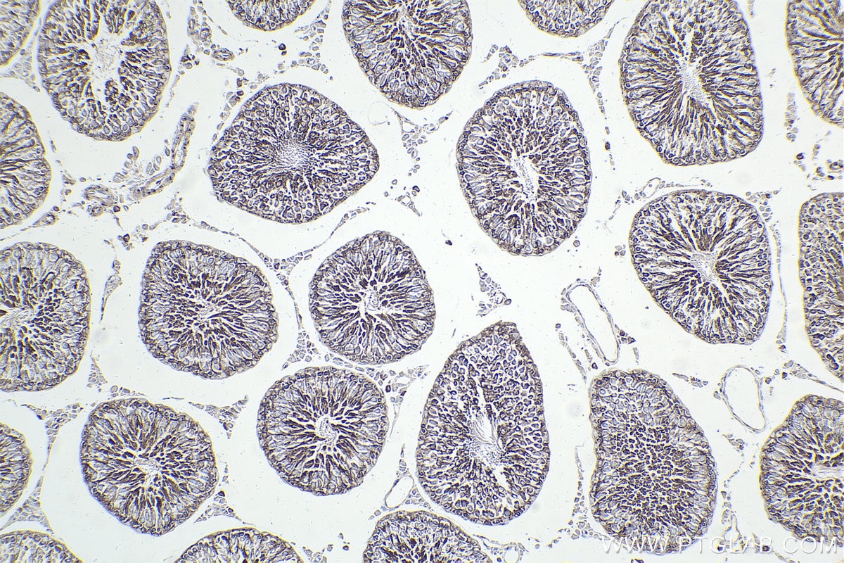Immunohistochemical analysis of paraffin-embedded rat testis tissue slide using KHC1889 (SORT1 IHC Kit).