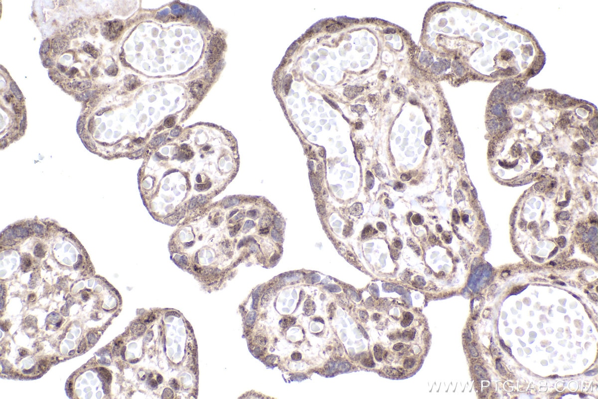 Immunohistochemical analysis of paraffin-embedded human placenta tissue slide using KHC2002 (SOX13 IHC Kit).